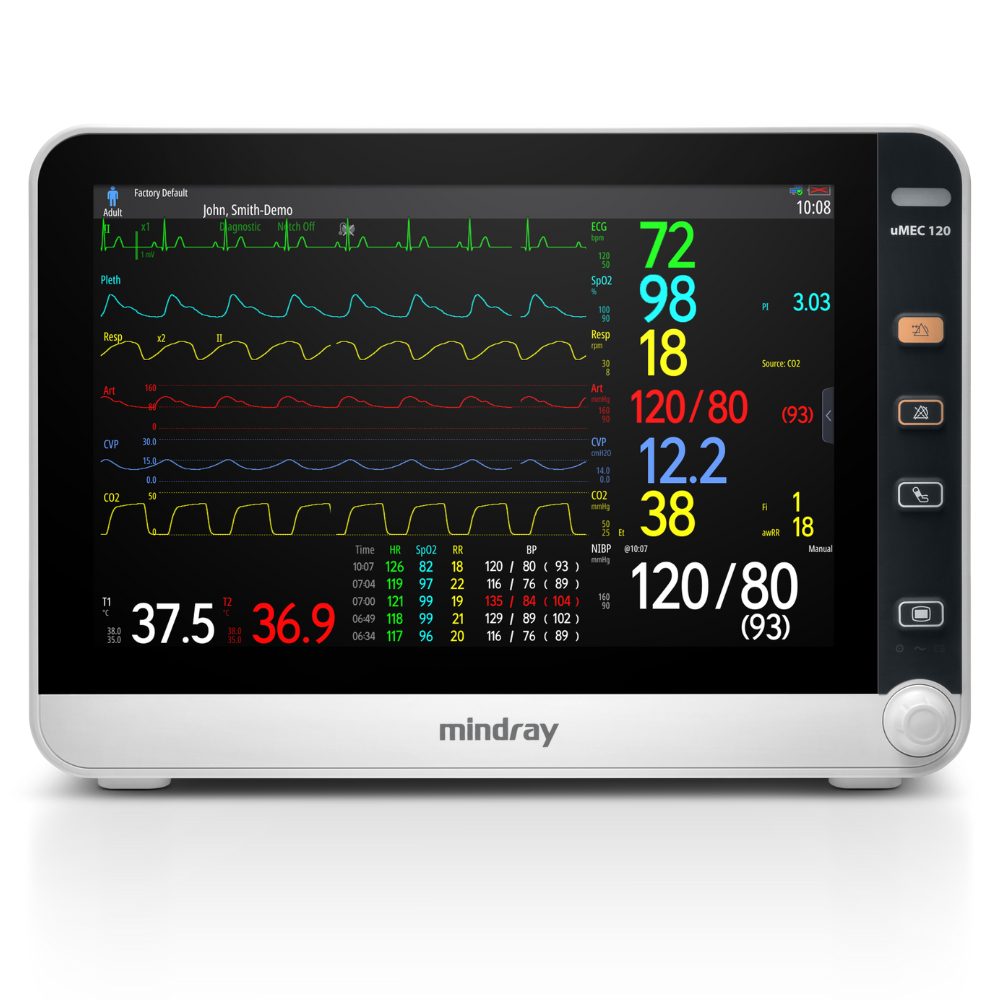 uMEC 120 mit Co²-Sidestream ohne Drucker und ohne Wi-Fi